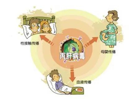 治愈丙肝的药物纳入医保啦丙肝治疗进入治愈新时代